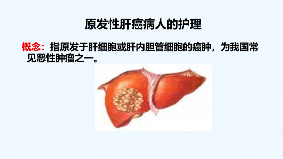 原发性肝癌病人的护理.pptx