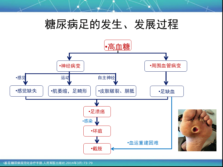 中国糖尿病足诊治指南(最新版).ppt_第2页
