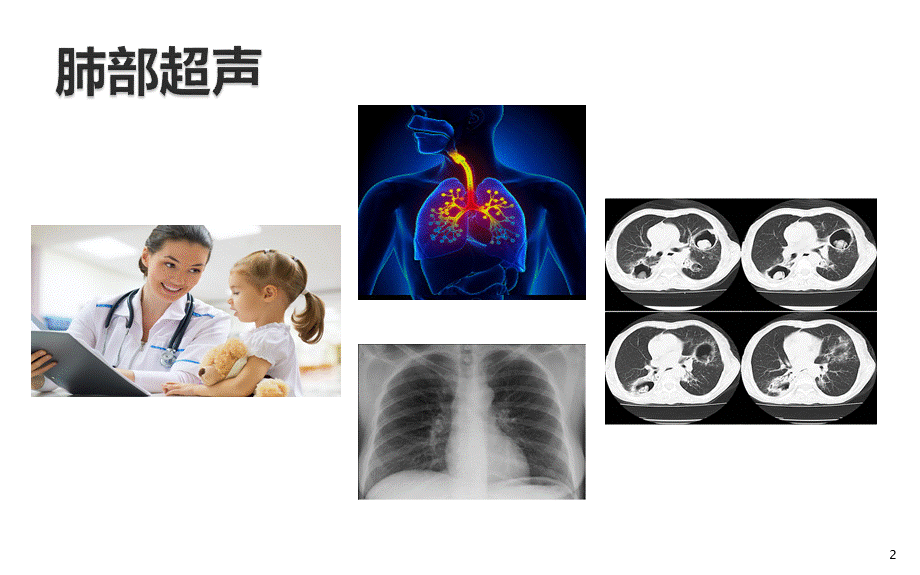 ICU肺部超声基础.pptx_第2页