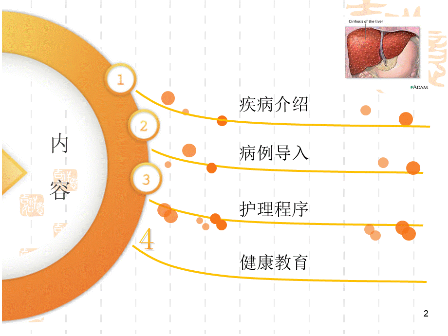 肝硬化病人的护理查房课件.ppt_第2页