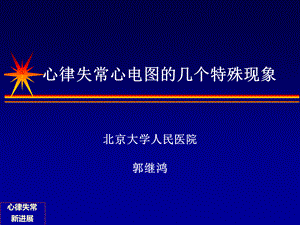 心律失常心电图的几个特殊现象.ppt