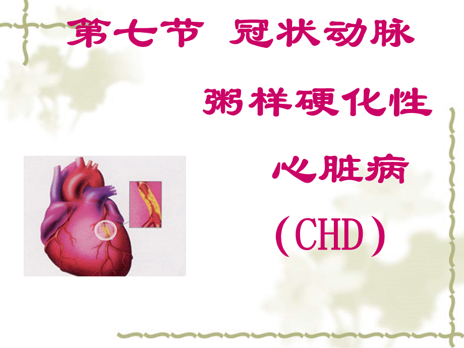 心脏硬化性心脏病.ppt_第1页