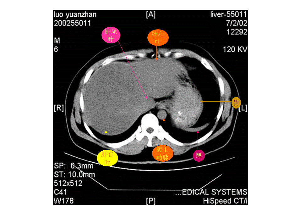 腹部CT教学课件.ppt_第3页