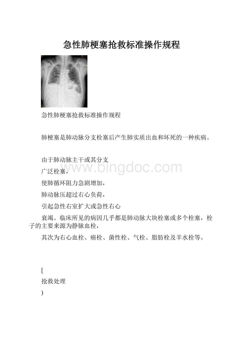 急性肺梗塞抢救标准操作规程.docx_第1页