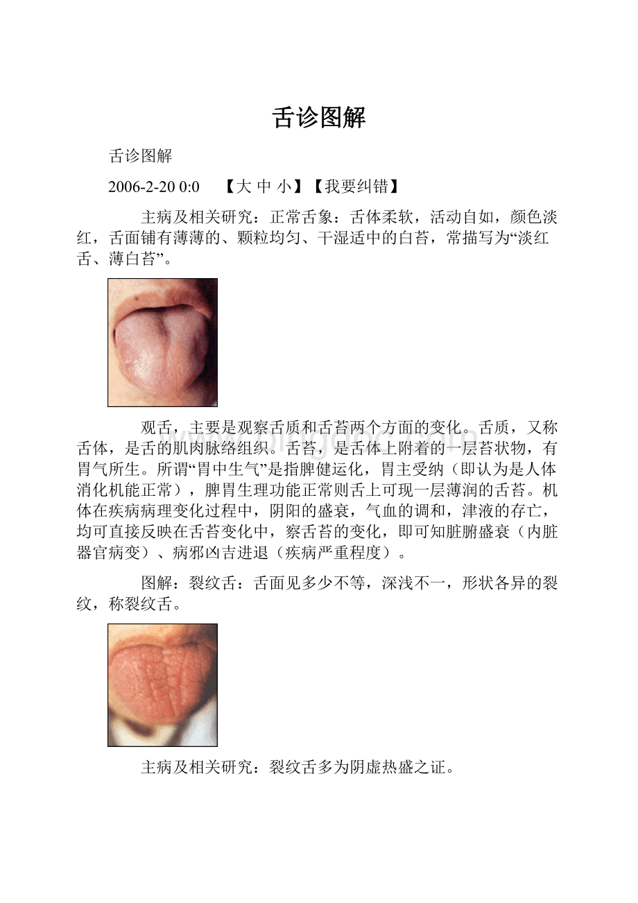 舌诊图解.docx_第1页