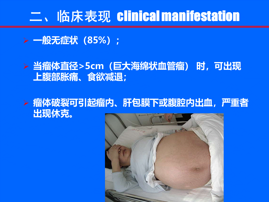 肝脏海绵状血管瘤-基础与介入.ppt_第3页