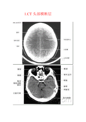 人体断面与影像解剖学.doc