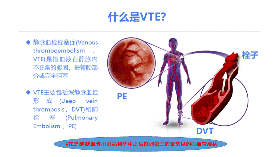 静脉血栓栓塞症VTE的诊断和治疗.pptx_第3页