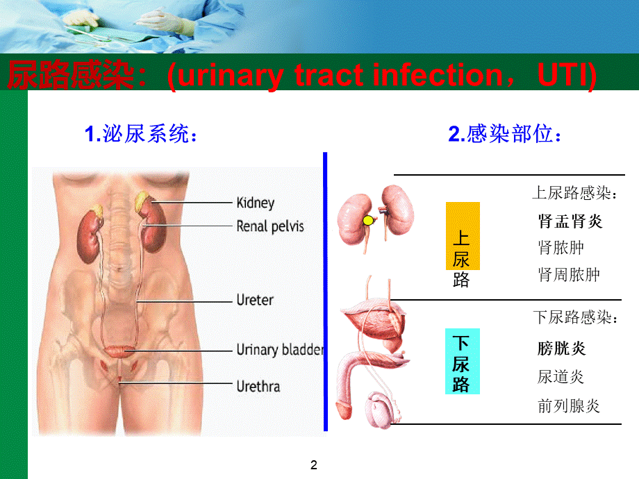 华纳凯林磷霉素钠氨丁三醇培训幻灯片.ppt_第2页