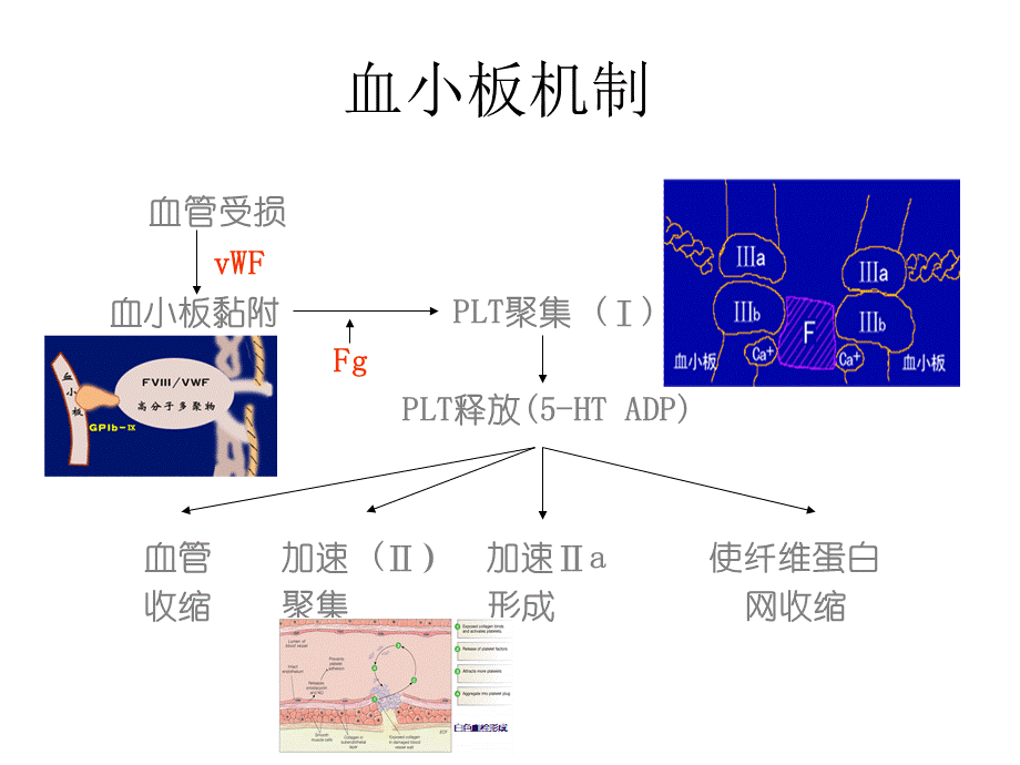 缺血性脑血管病介入治疗抗血小板策略中国专家共识.ppt_第3页