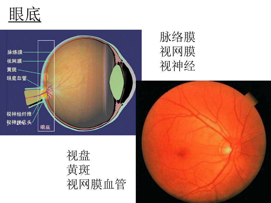 附二七组-眼科学.pptx_第3页