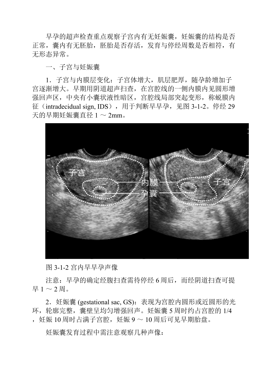 第三章 妊娠生理的超声诊断.docx_第3页