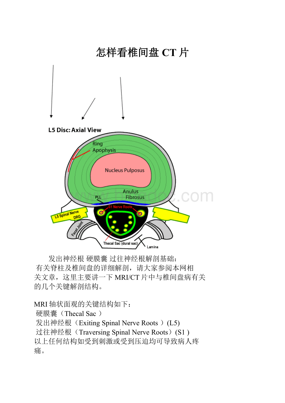 怎样看椎间盘CT片.docx_第1页