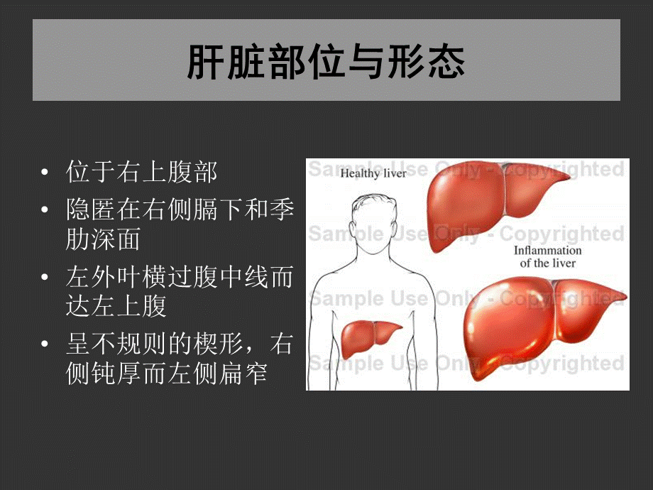 肝脏疾病及门脉高压症.ppt_第3页