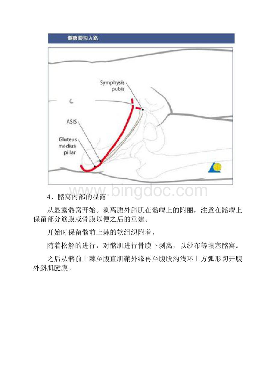 髂腹股沟入路解剖仅供参考Word格式.docx_第3页