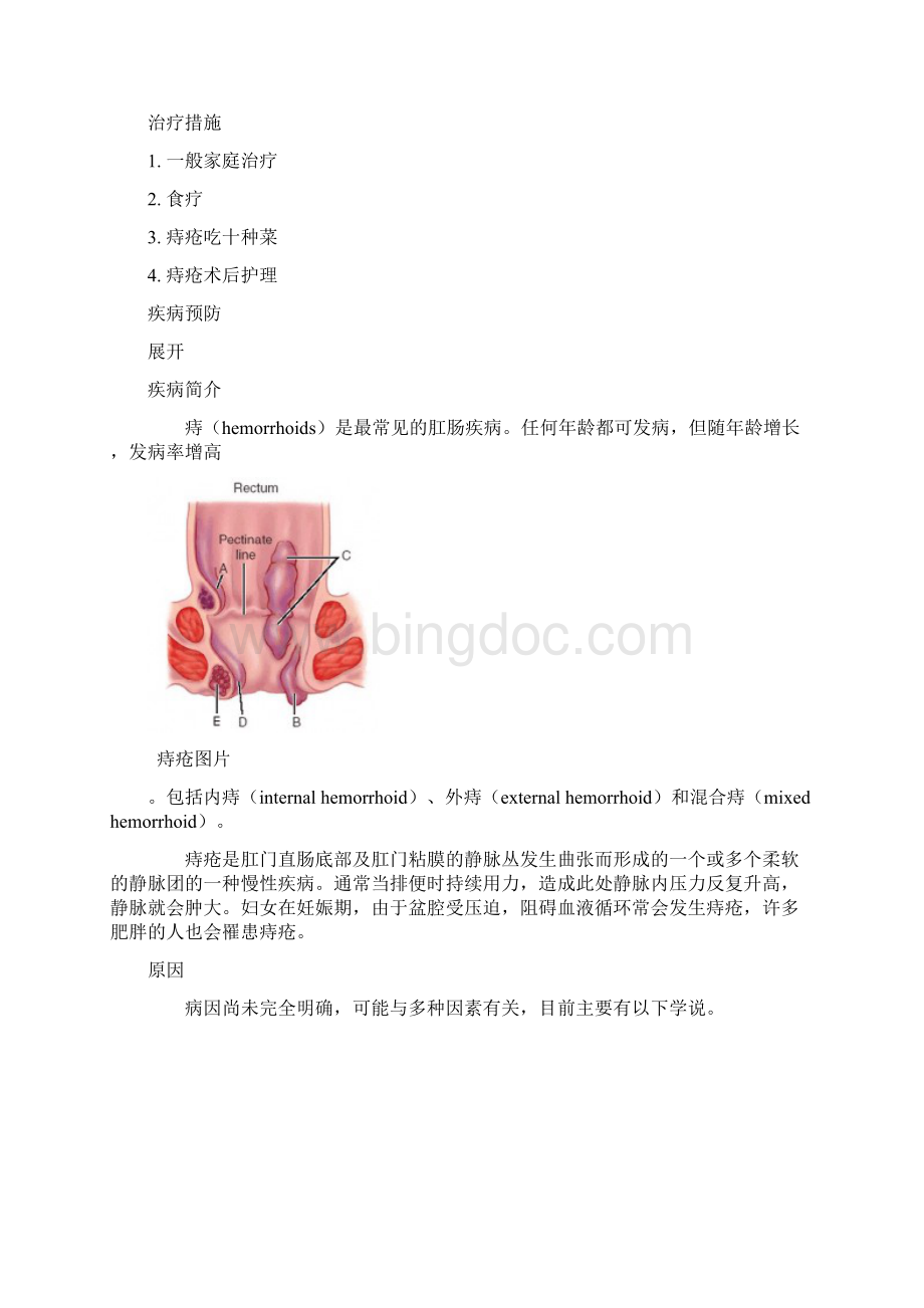 痔疮治疗.docx_第3页