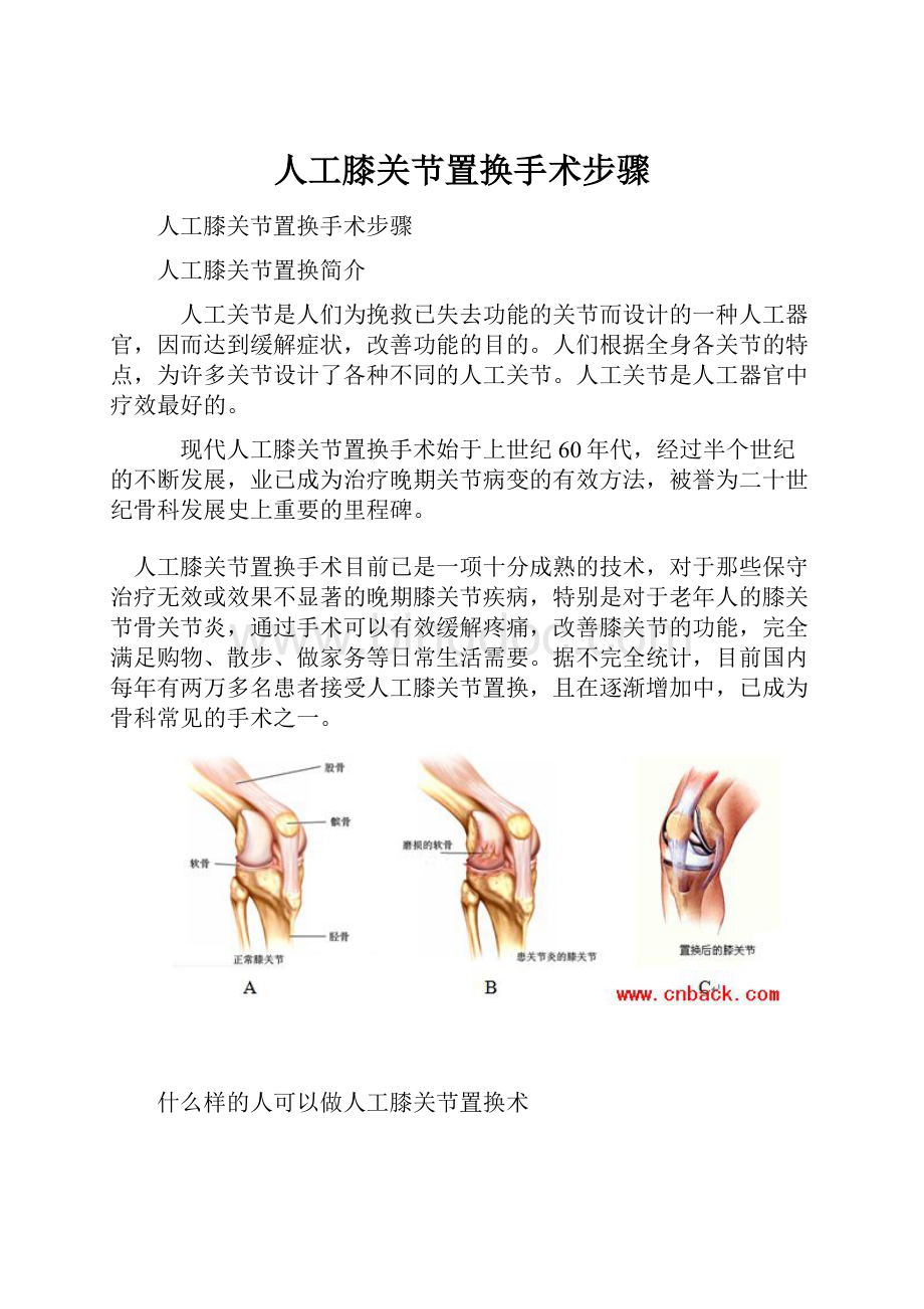 人工膝关节置换手术步骤.docx