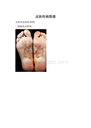 皮肤性病图谱.docx