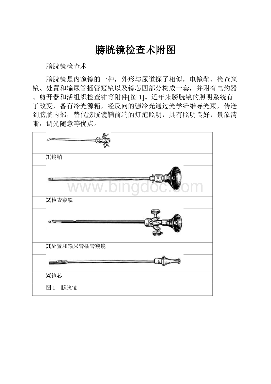 膀胱镜检查术附图.docx