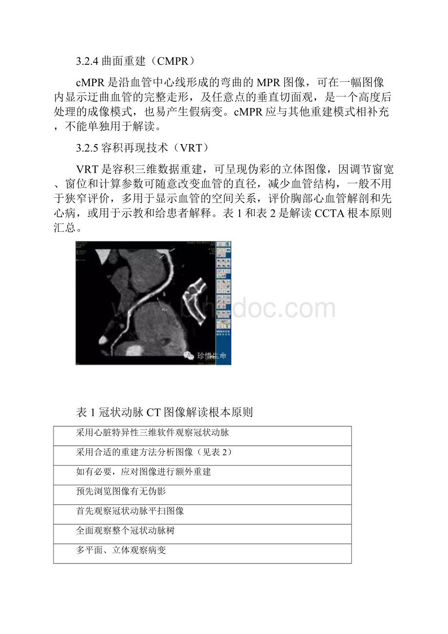 冠状动脉CT图像解读和报告指南规范SCCT指南doc.docx_第3页