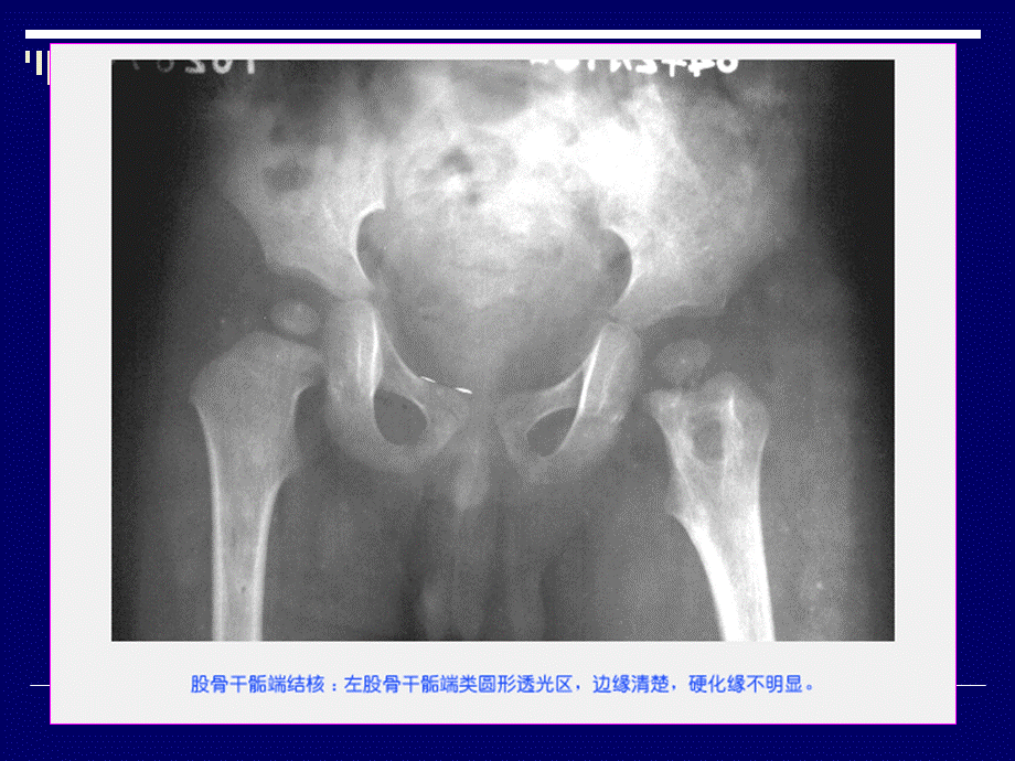 医学PPT课件骨科疾病影像学大全.ppt