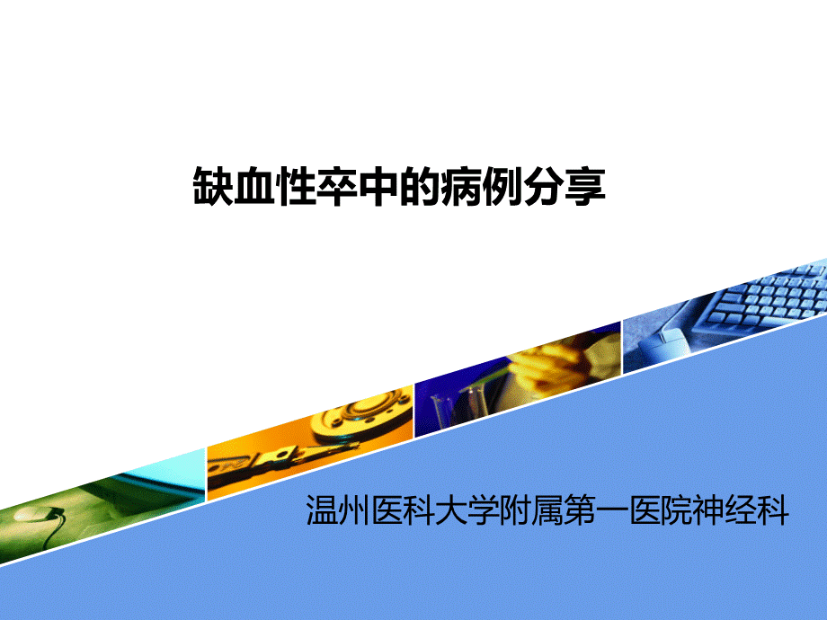 缺血性卒中的病例分享.ppt