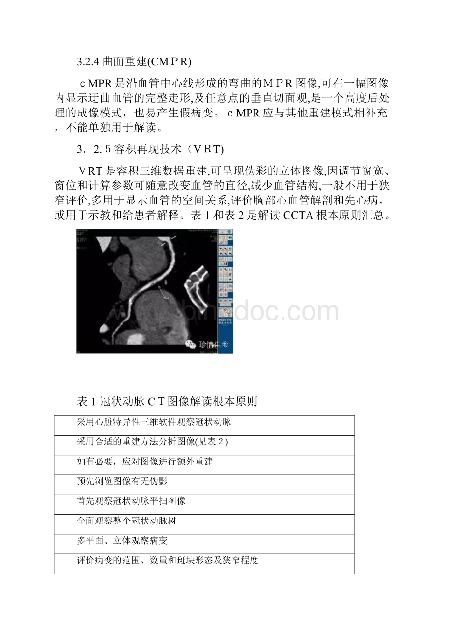 冠状动脉CT图像解读和报告指南年SCCT指南.docx_第3页