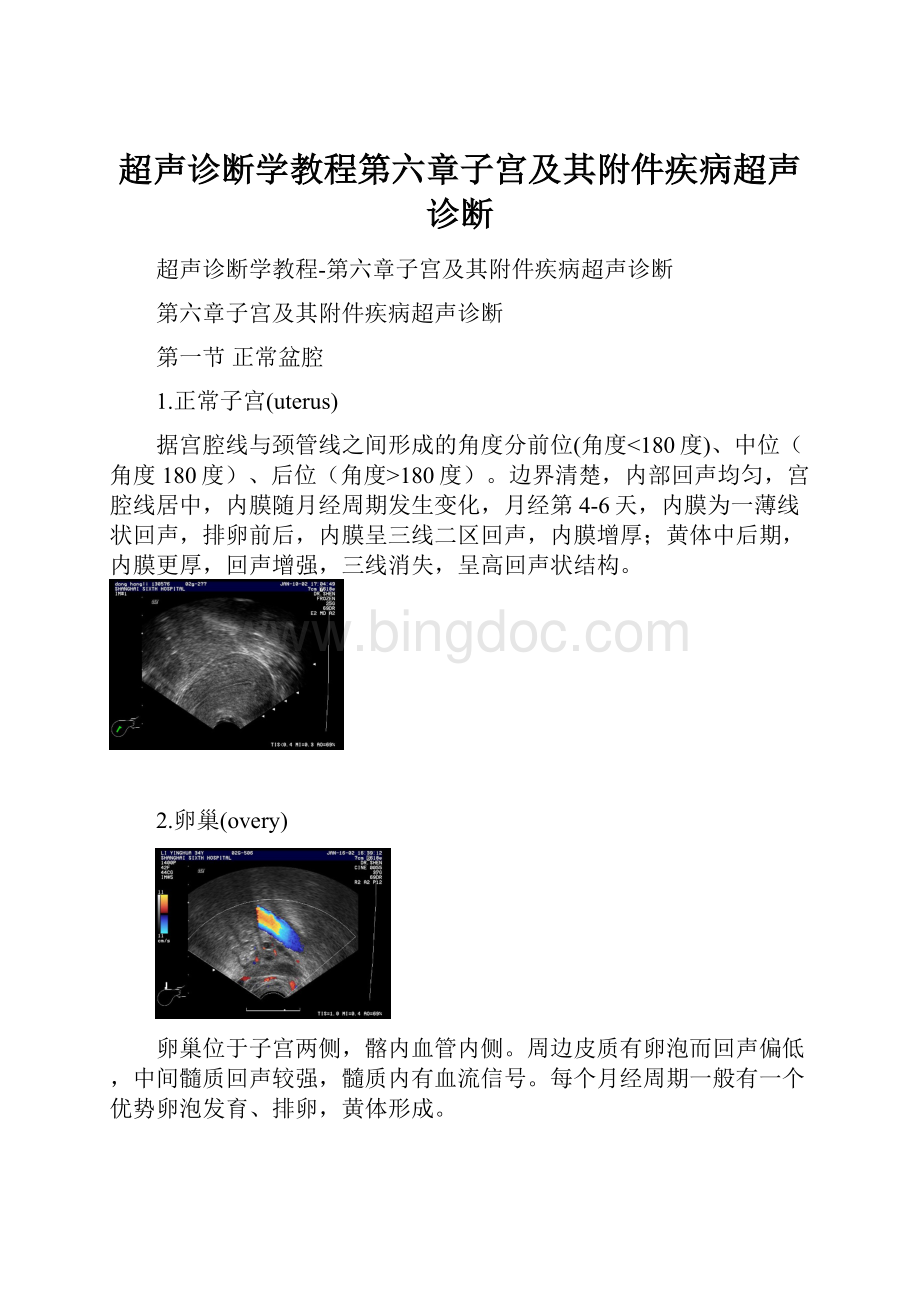 超声诊断学教程第六章子宫及其附件疾病超声诊断.docx