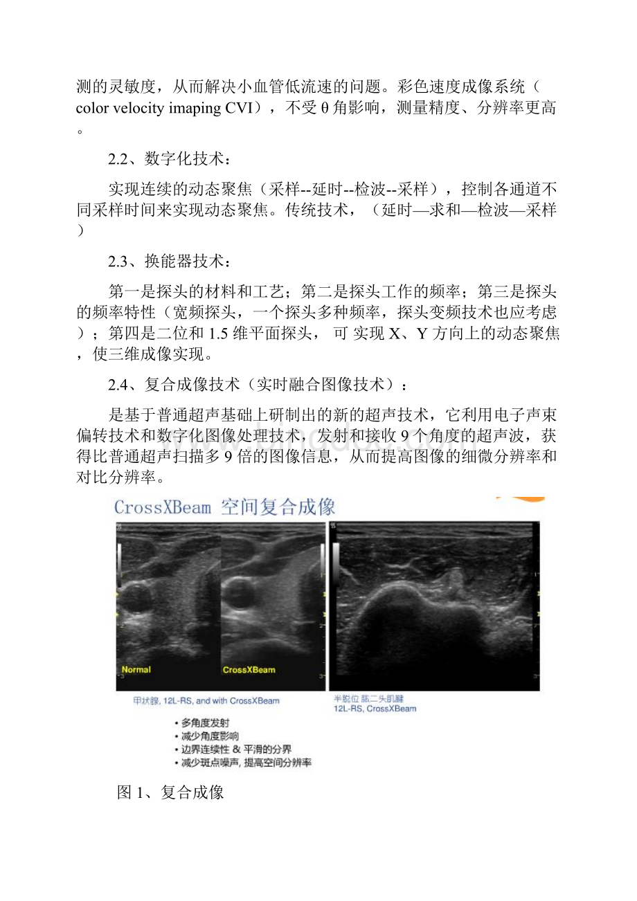 GE彩超技术分析报告.docx_第2页