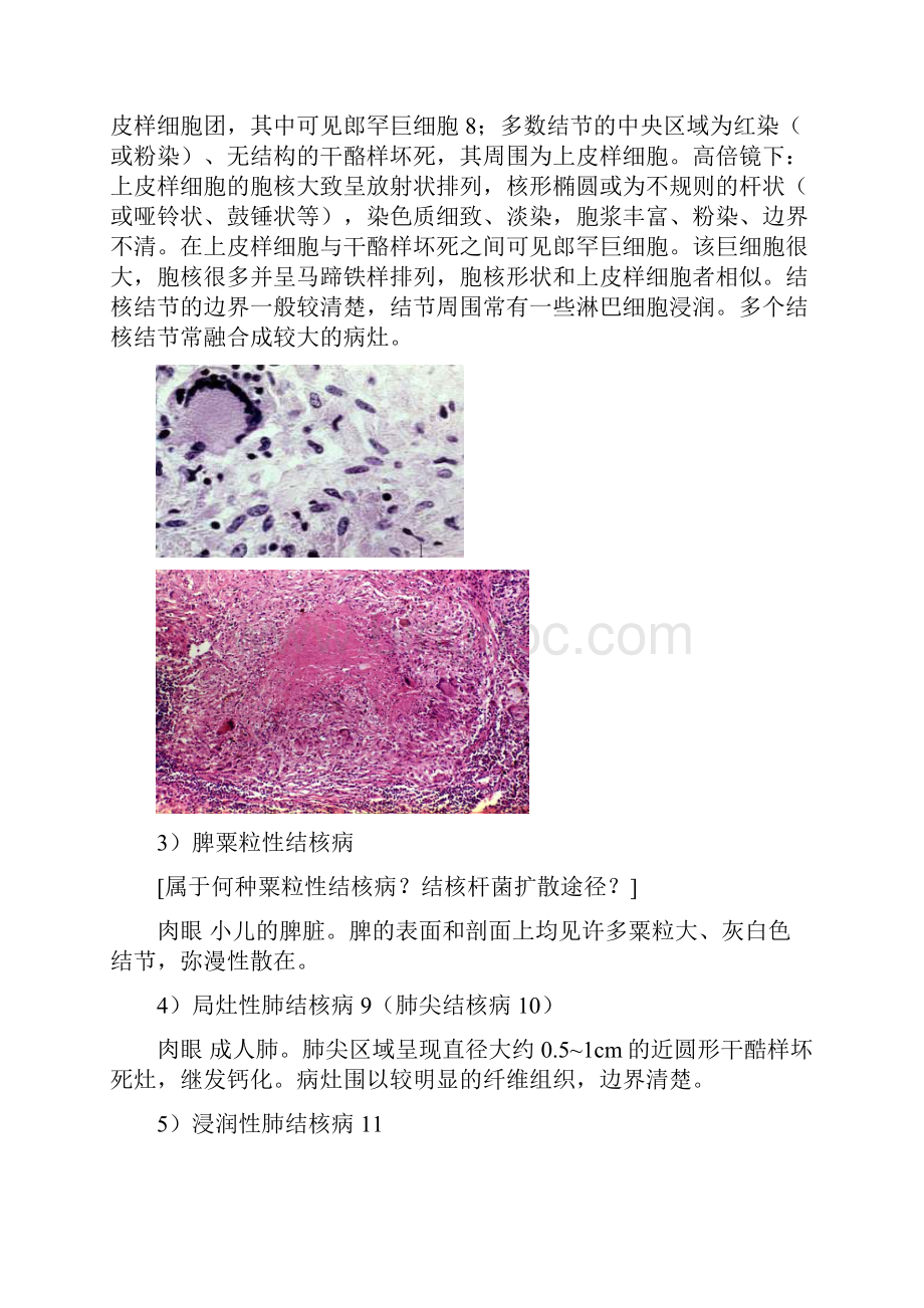 传染病和寄生虫病.docx_第3页