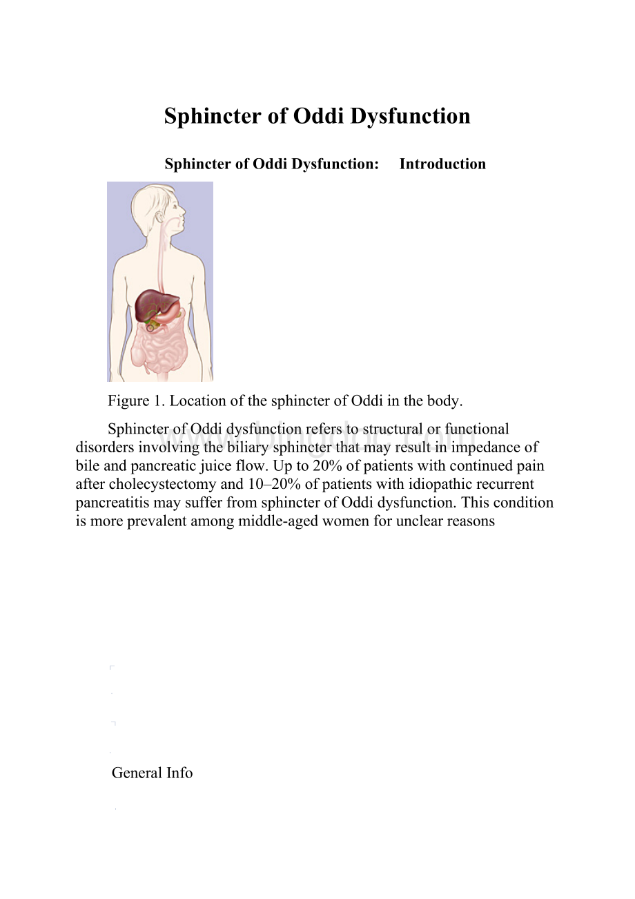 Sphincter of Oddi Dysfunction.docx